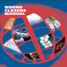 Ethicon Wound Closure Manual 101702 Ethicon Wound Closure Manual 101702